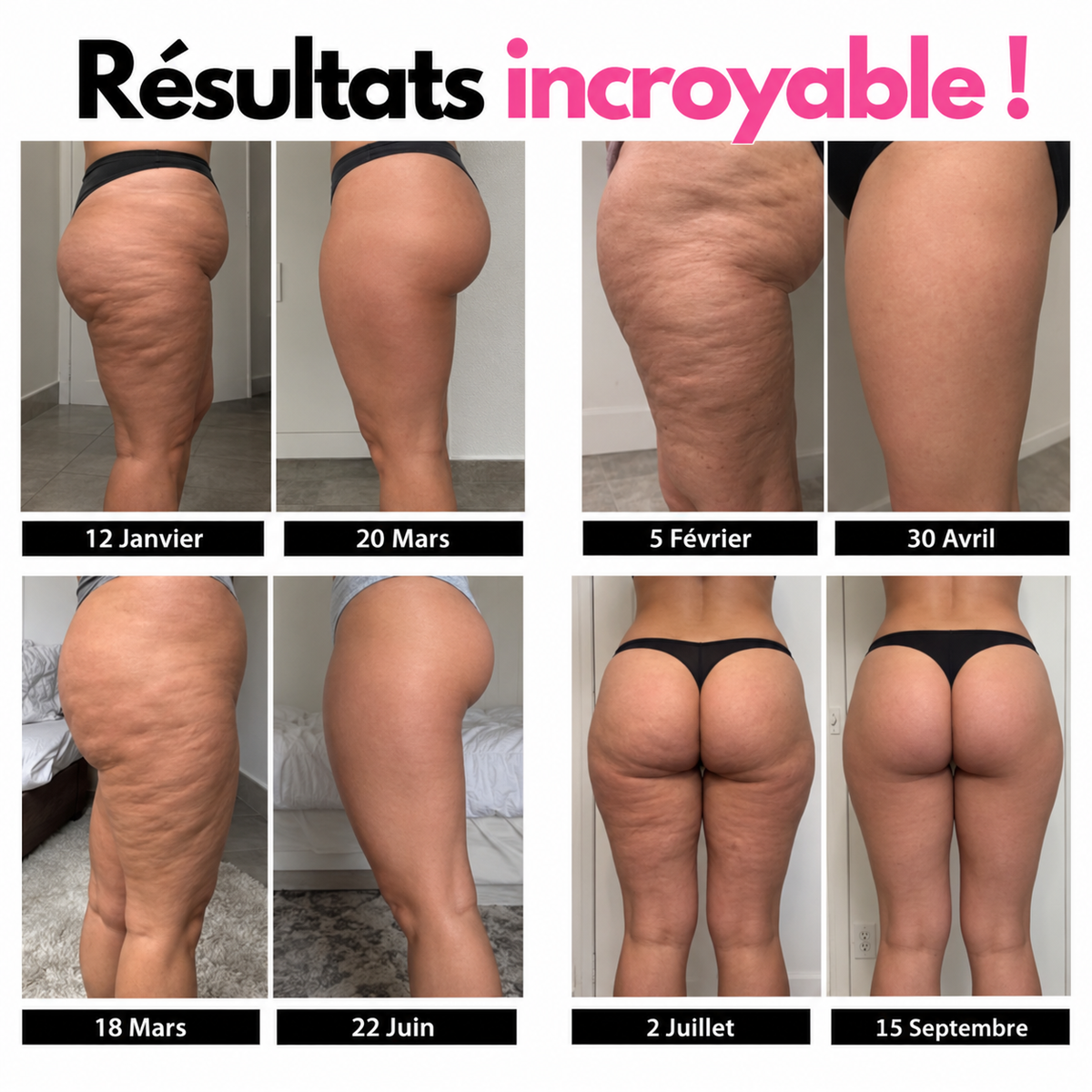 Legging Anti-cellulite Rose VELANI™